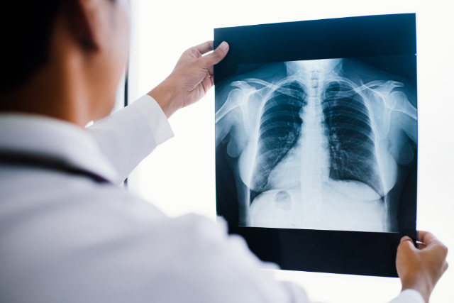 X-rays